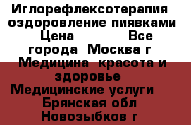 Иглорефлексотерапия, оздоровление пиявками › Цена ­ 3 000 - Все города, Москва г. Медицина, красота и здоровье » Медицинские услуги   . Брянская обл.,Новозыбков г.